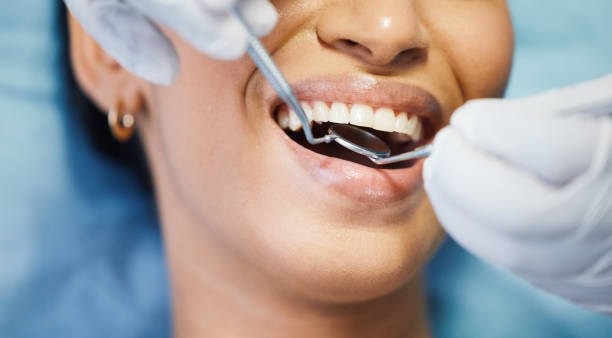 Best Emergency Dental Care for Sports Injuries in Folsom, NJ